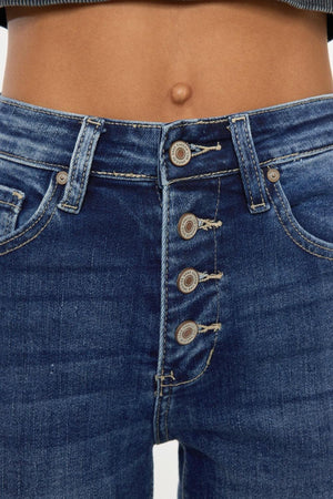 a close up of a person's jeans with buttons